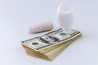 Model of dental implant in Fort Worth on stack of money