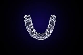 Clear aligner for Invisalign in Fort Worth. 