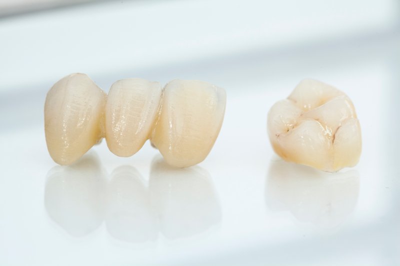 same-day dental crowns