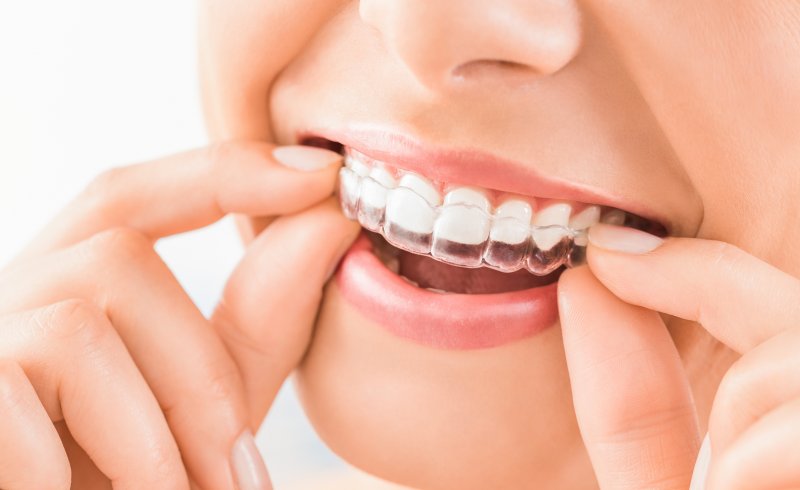 Young woman putting in Invisalign tray