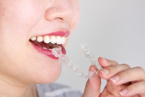 woman smiling wearing invisalign braces