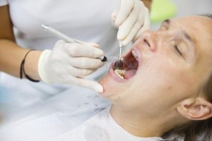 woman mouth open receiving dental care